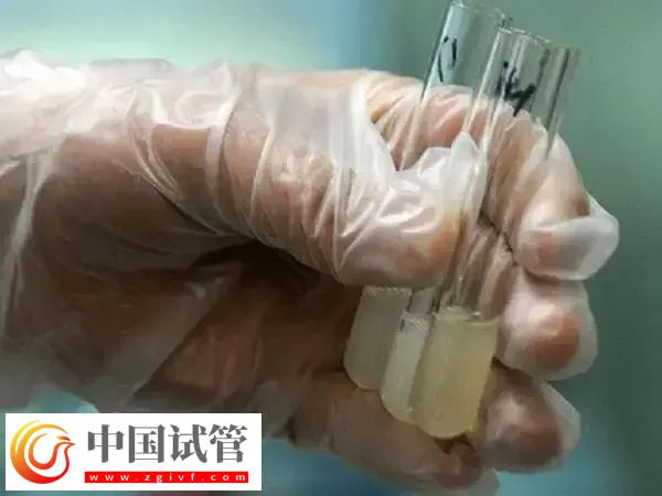 试管婴儿如何取精(图1)