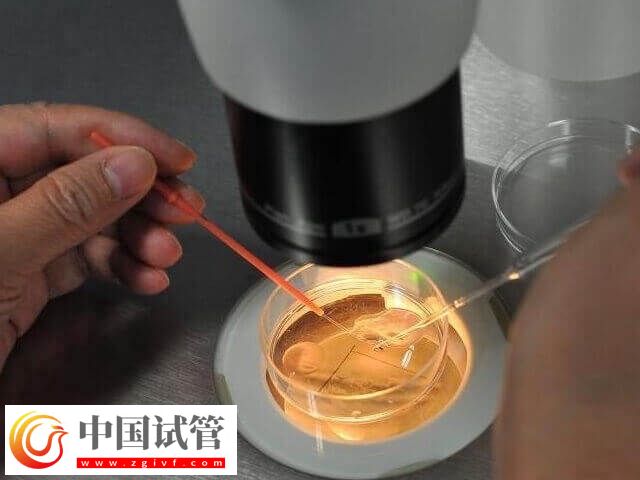 大龄试管婴儿好孕经验有哪些(图1)