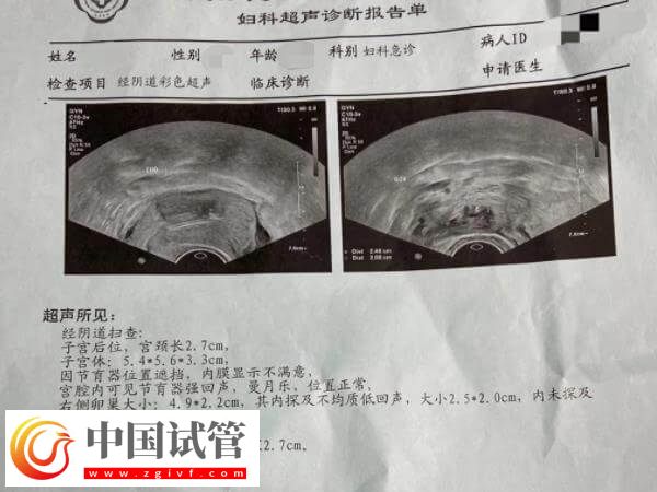 试管移植后一超二超三超时间多久(图1)