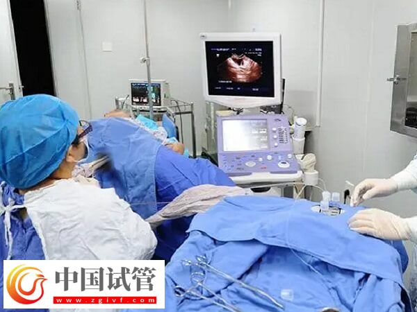 自然周期取卵前能不能同房(图1)