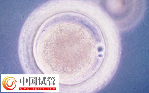 一级胚胎是不是很难得(图1)