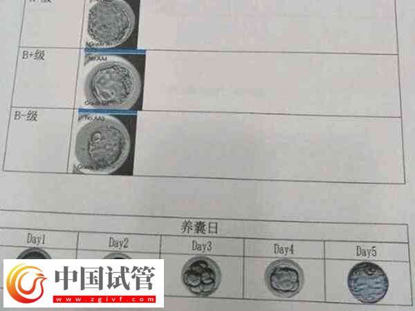 试管养囊成功的是否都是优胚(图1)