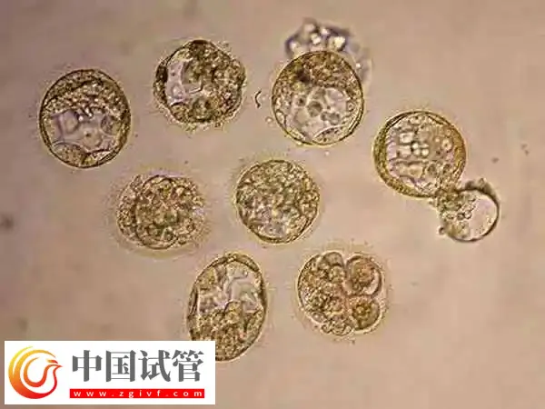 胚胎培养需要多长时间(图1)