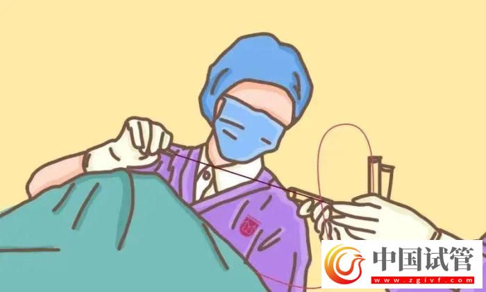 试管婴儿有哪些出乎意料的概念？(图4)