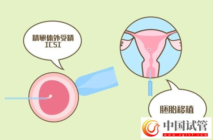 试管婴儿有哪些出乎意料的概念？(图6)