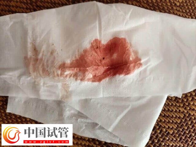 试管移植后不规则出血怎么办(图1)