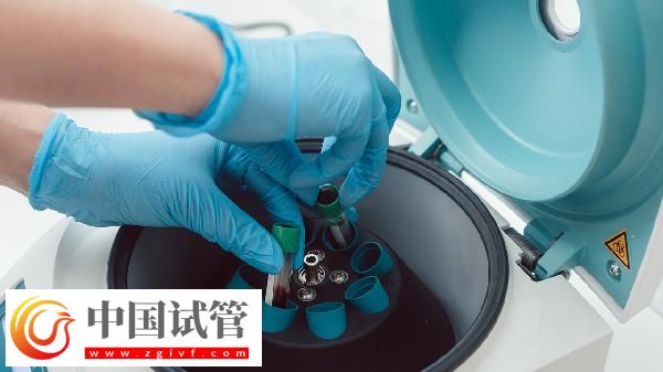 血常规五项是哪五项(图3)