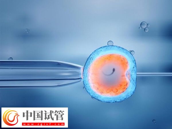 50岁试管婴儿的条件有哪些(图1)