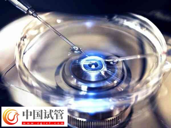 试管一般取多少卵好(图1)