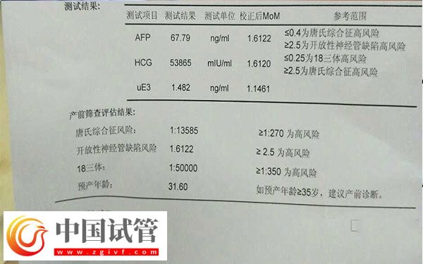 HCG值能不能看出单胎还是双胎(图1)