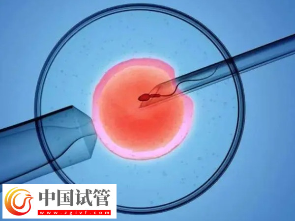 高龄试管有什么风险(图2)