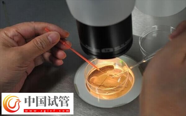 试管前如何调理身体(图1)