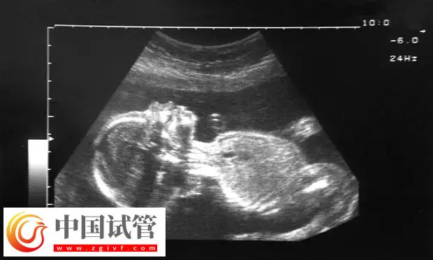 助孕4月后出血原因(图4)