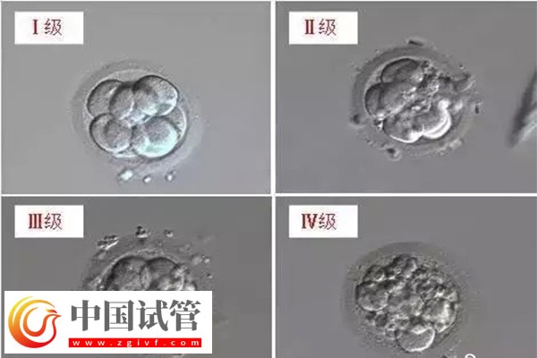 4个胚胎做试管够不够(图1)