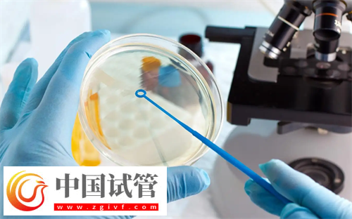 多囊患者试管选择什么方案好？(图1)