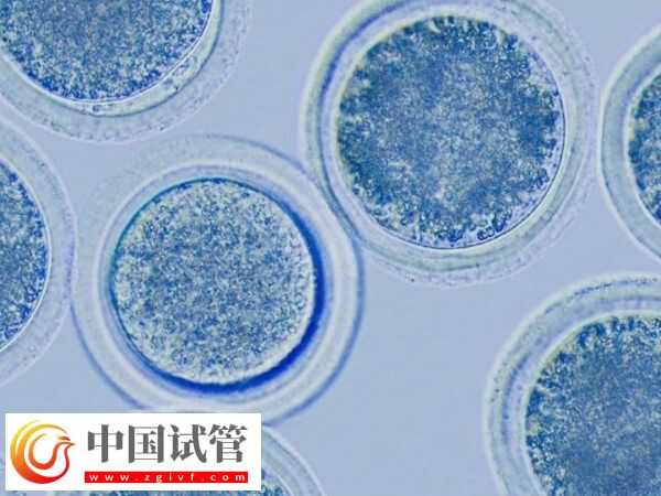 促排6个基础卵泡能取多少个卵(图1)