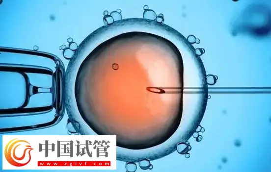 深圳生殖中心最好的医院：深圳市人民医院排在榜首(图3)