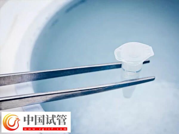 试管冻精费用是多少(图2)