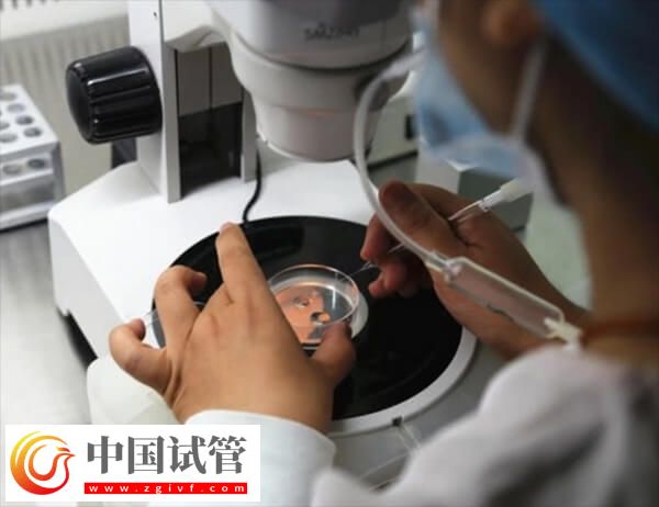 胚胎质量一般是移植还是促排好(图2)