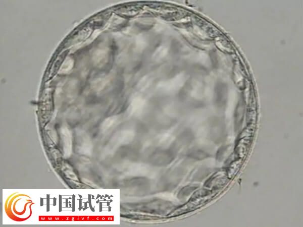 胚胎质量一般是移植还是促排好(图1)