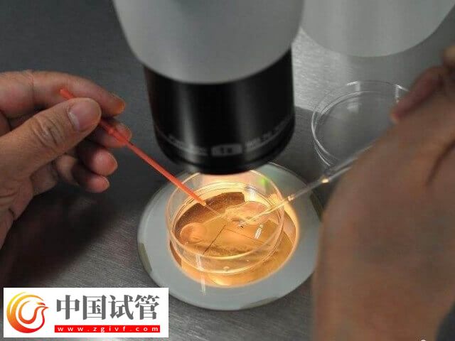 胚胎着床失败是什么情况(图1)