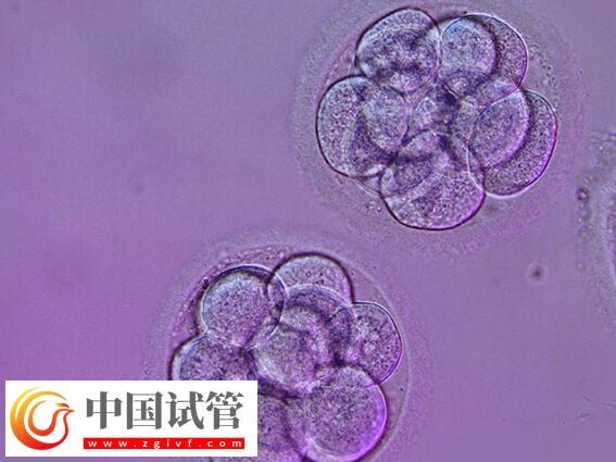 试管婴儿什么情况下养囊(图1)
