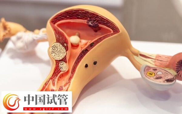 试管巧囊4cm影响着床(图2)