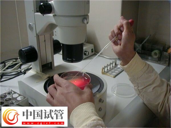 试管婴儿能否一次移植成功(图1)