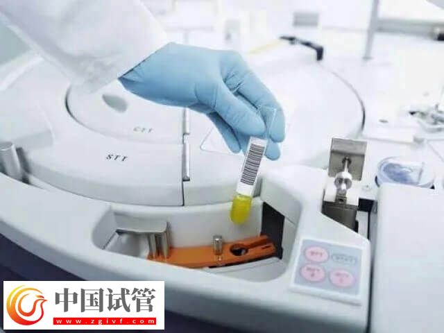 试管婴儿适用于哪些人(图2)