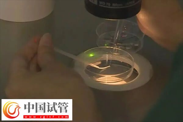 做试管一般取卵几个(图2)