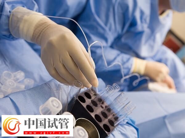 做试管婴儿的时间怎么安排(图1)