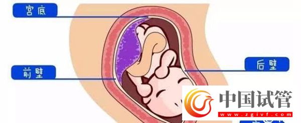 1分钟了解胎盘前壁和后壁的3大区别，为孕期做好准备(图2)