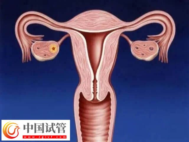 amh低做试管成功可能性大不大(图1)