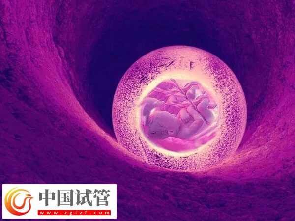 子宫憩室影不影响试管移植(图2)