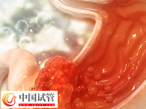 做试管吃芬必得的作用和功效(图2)