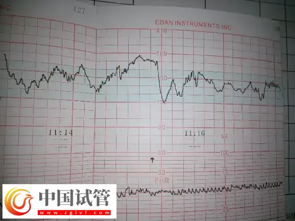 试管胚胎移植做二超能不能转产科(图2)