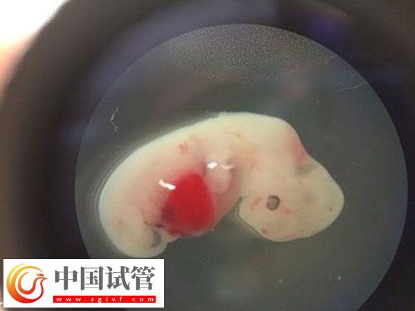 如何解读胚胎筛查结果报告单(图1)