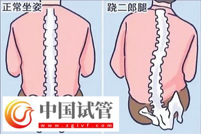 不良体态正悄悄损害你的健康(图2)