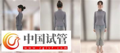 不良体态正悄悄损害你的健康(图4)