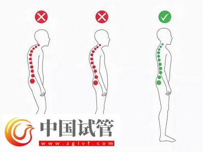 不良体态正悄悄损害你的健康(图1)