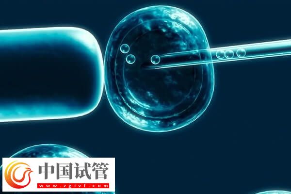 试管移植反复不着床需要查什么(图1)