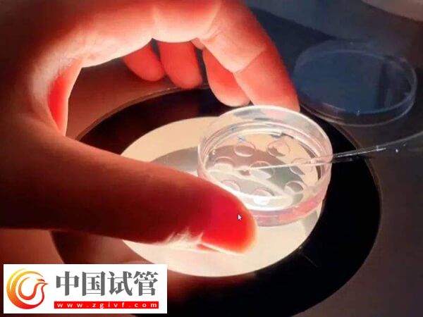 胚胎移植后大便不成形怎么回事(图1)