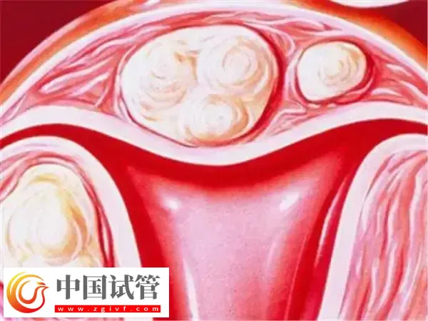 为什么医生不给移植鲜胚(图2)