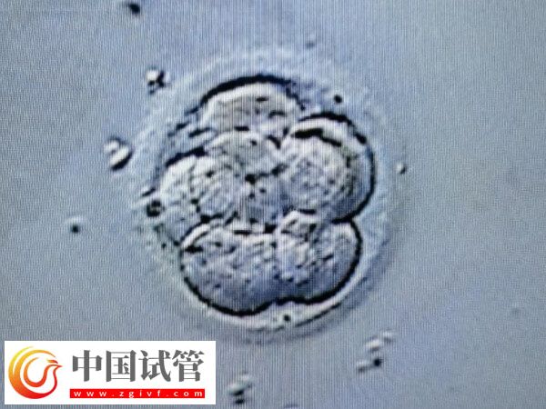 试管一次不成功二次移植费用多少(图2)
