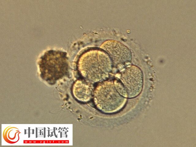 囊胚4bb和5bb哪个成功率高(图1) 囊胚4bb和5bb哪个成功率高(图1)