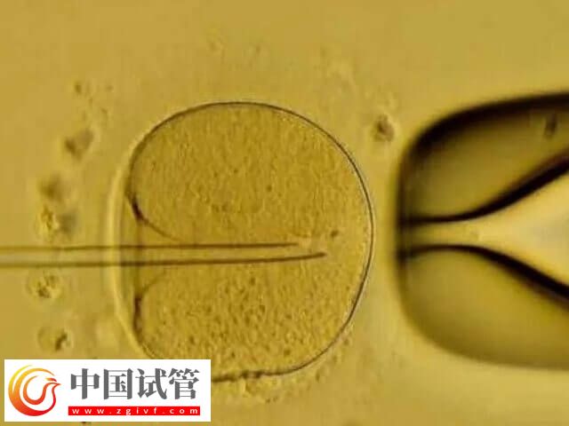 5天囊胚和3天鲜胚有哪些区别(图2) 5天囊胚和3天鲜胚有哪些区别(图2)