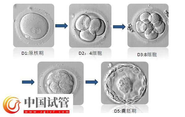移植囊胚容易变成双胞胎是怎么回事(图2) 移植囊胚容易变成双胞胎是怎么回事(图2)
