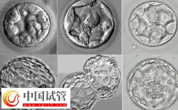 移植囊胚容易变成双胞胎是怎么回事(图1) 移植囊胚容易变成双胞胎是怎么回事(图1)