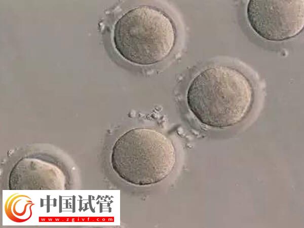 哪些情况不能移植鲜胚(图1) 哪些情况不能移植鲜胚(图1)