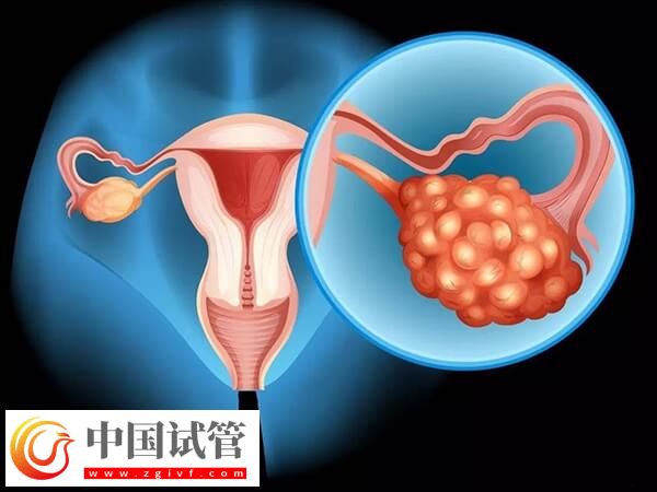 哪些情况不能移植鲜胚(图2) 哪些情况不能移植鲜胚(图2)